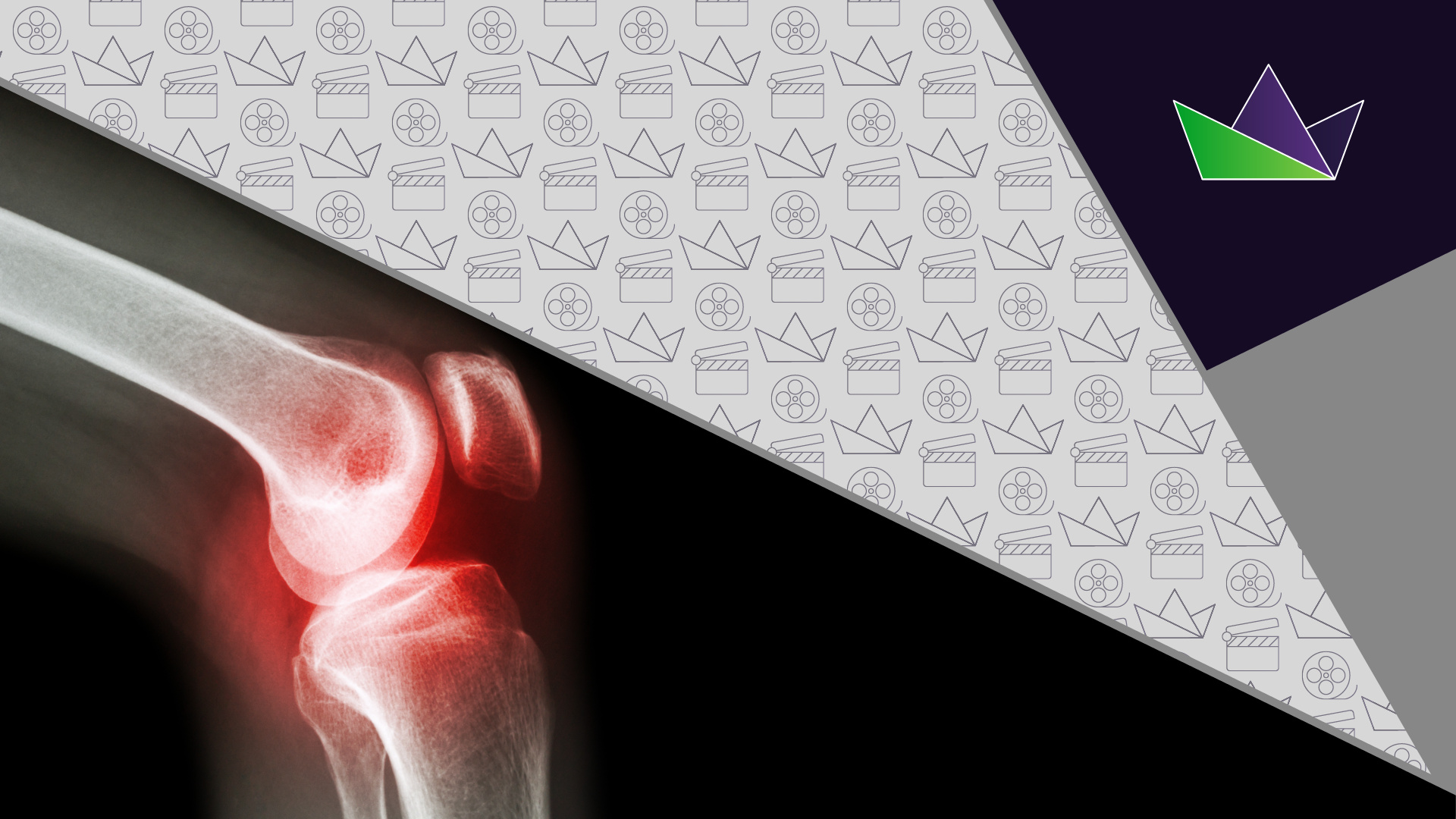 What are the current investigational treatments for osteoarthritis-associated pain?
