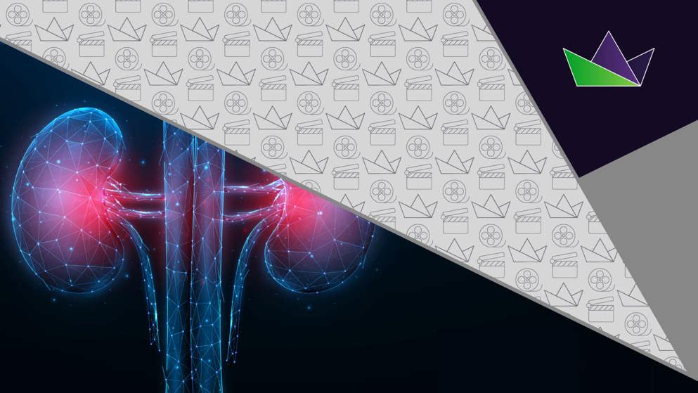 What were some of the research highlights regarding treatment of CKD with SGLT2 inhibitors