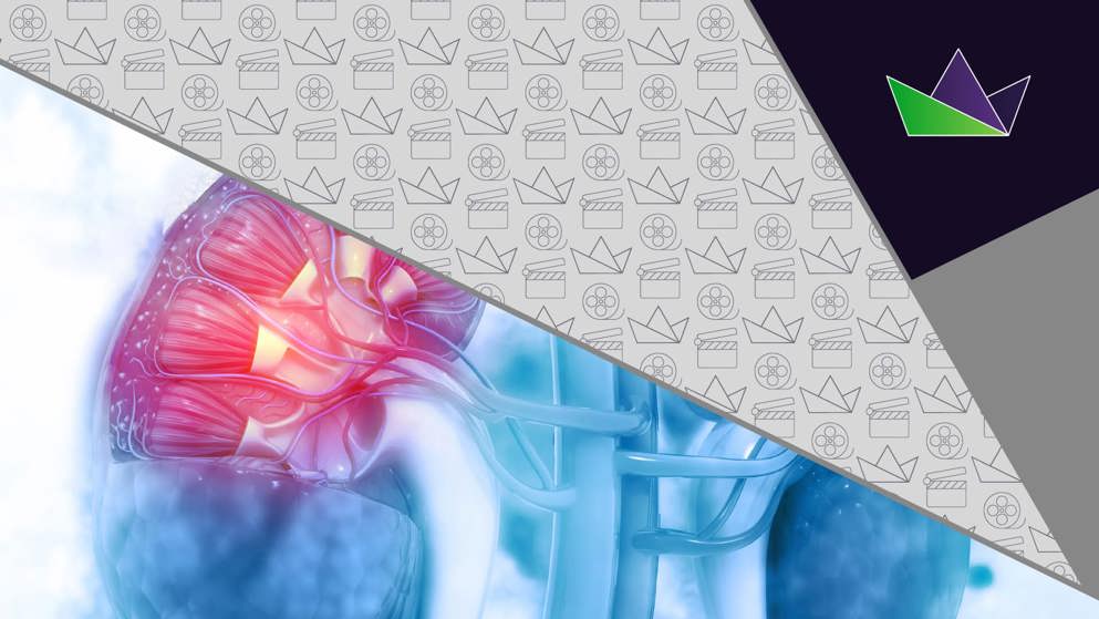 What were some of the research highlights regarding the use of MRAs for treatment of CKD