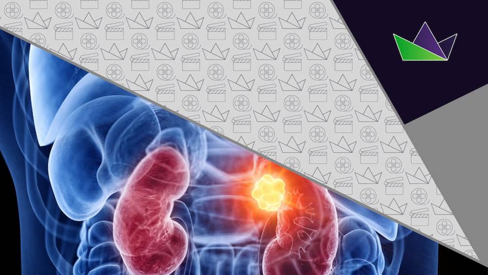 What are the complications and burden of chronic kidney disease