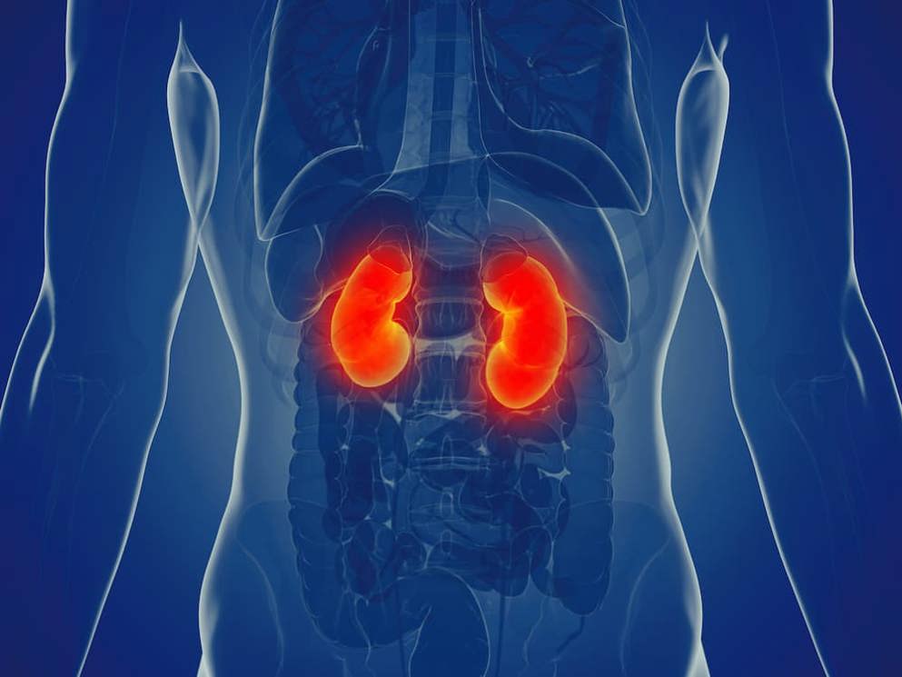 Kidney scan, male