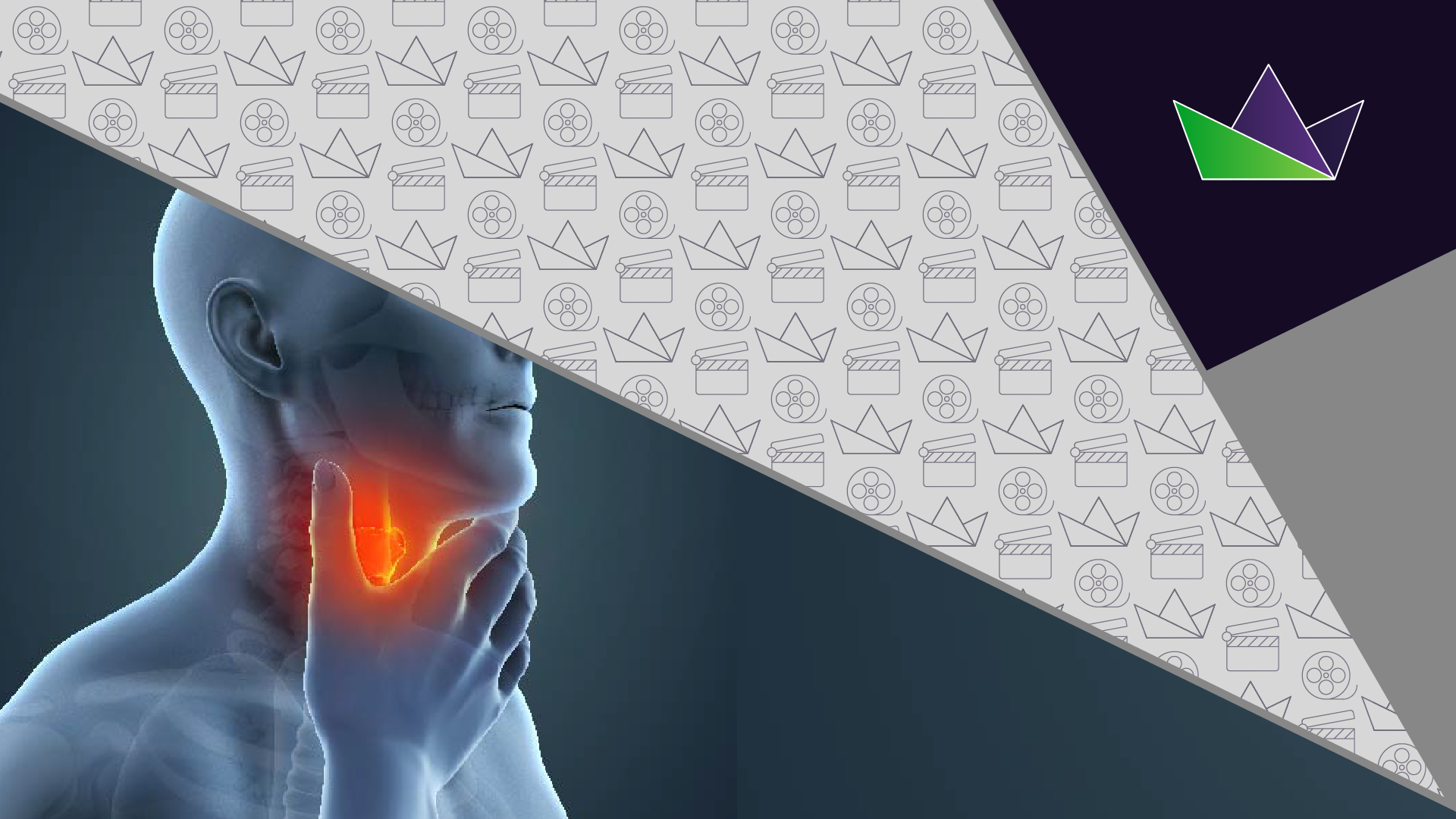 Real-world challenges of thyroid cancer management: patient stratification and molecular testing for RET alterations