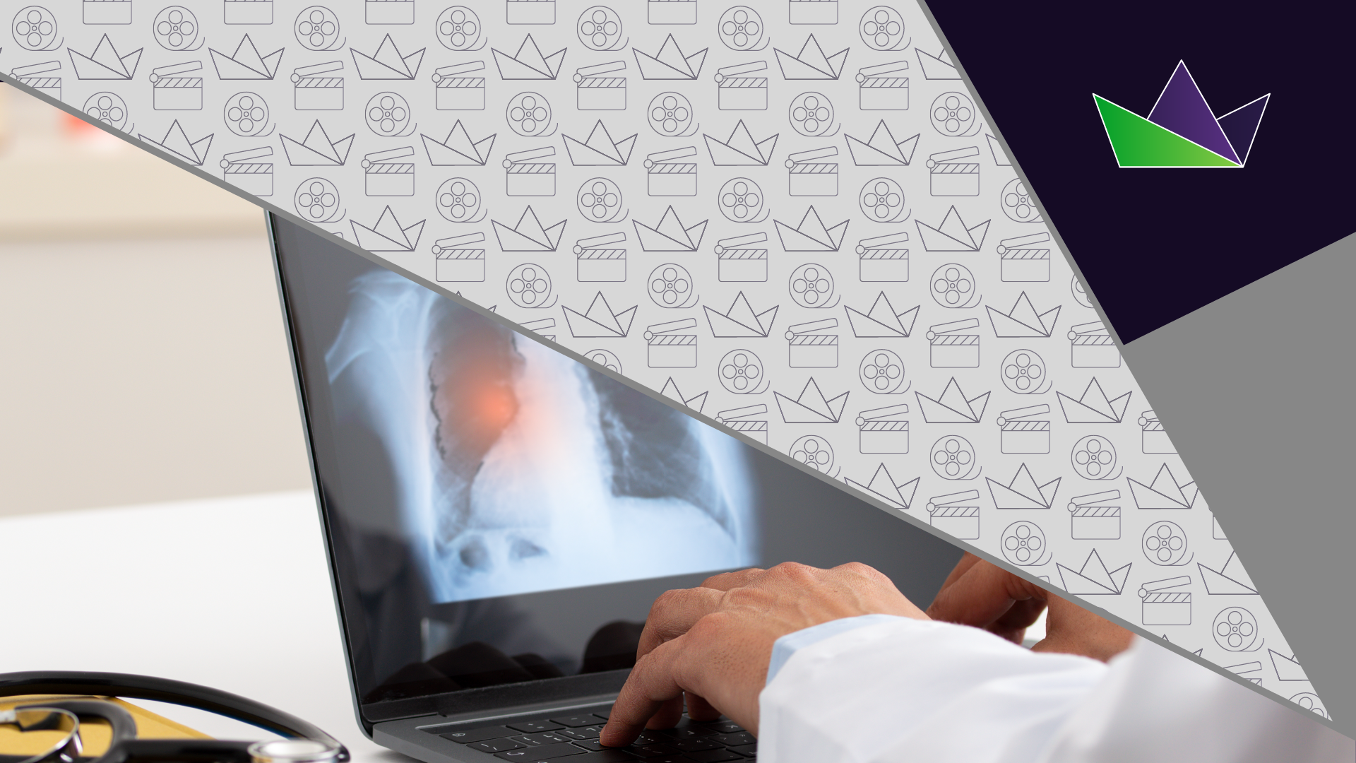 Stratifying NSCLC patients for RET inhibitor treatment