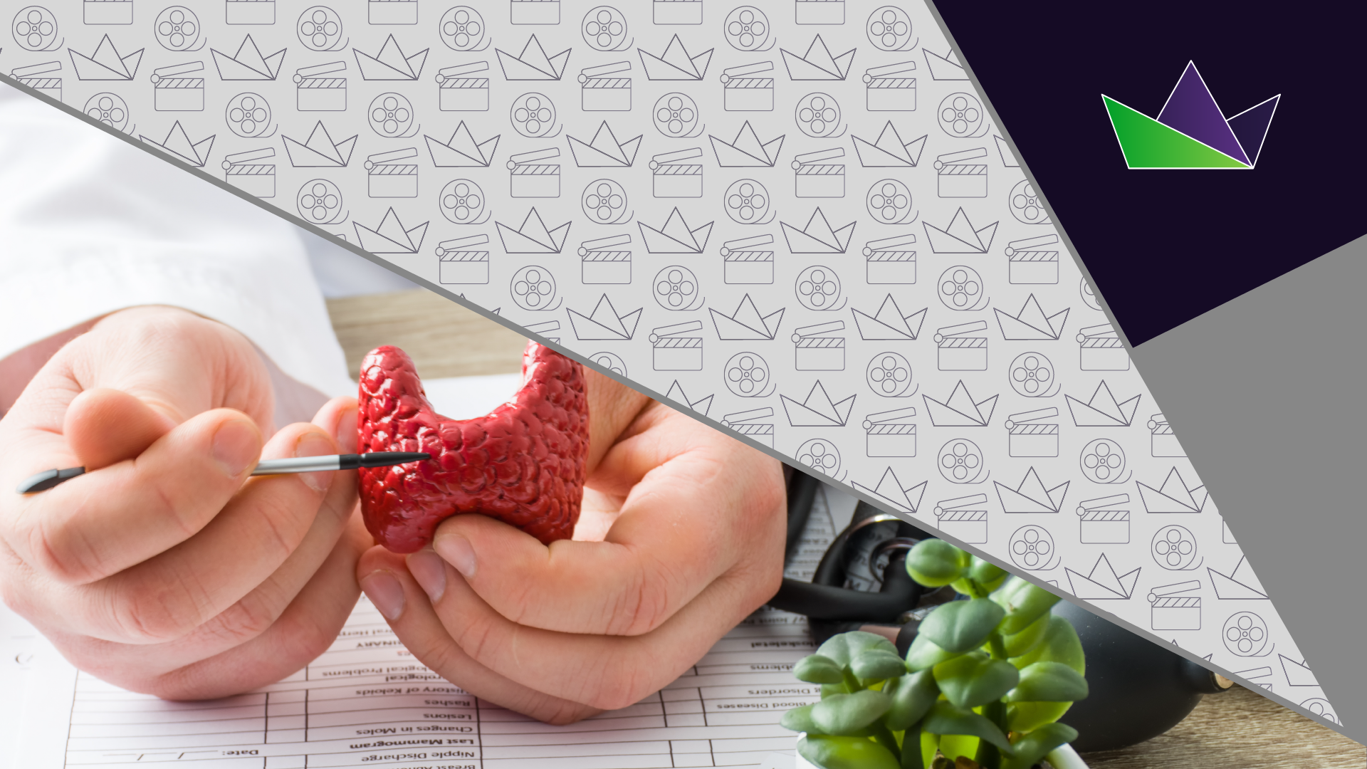 Stratifying thyroid cancer patients for RET inhibitor treatment