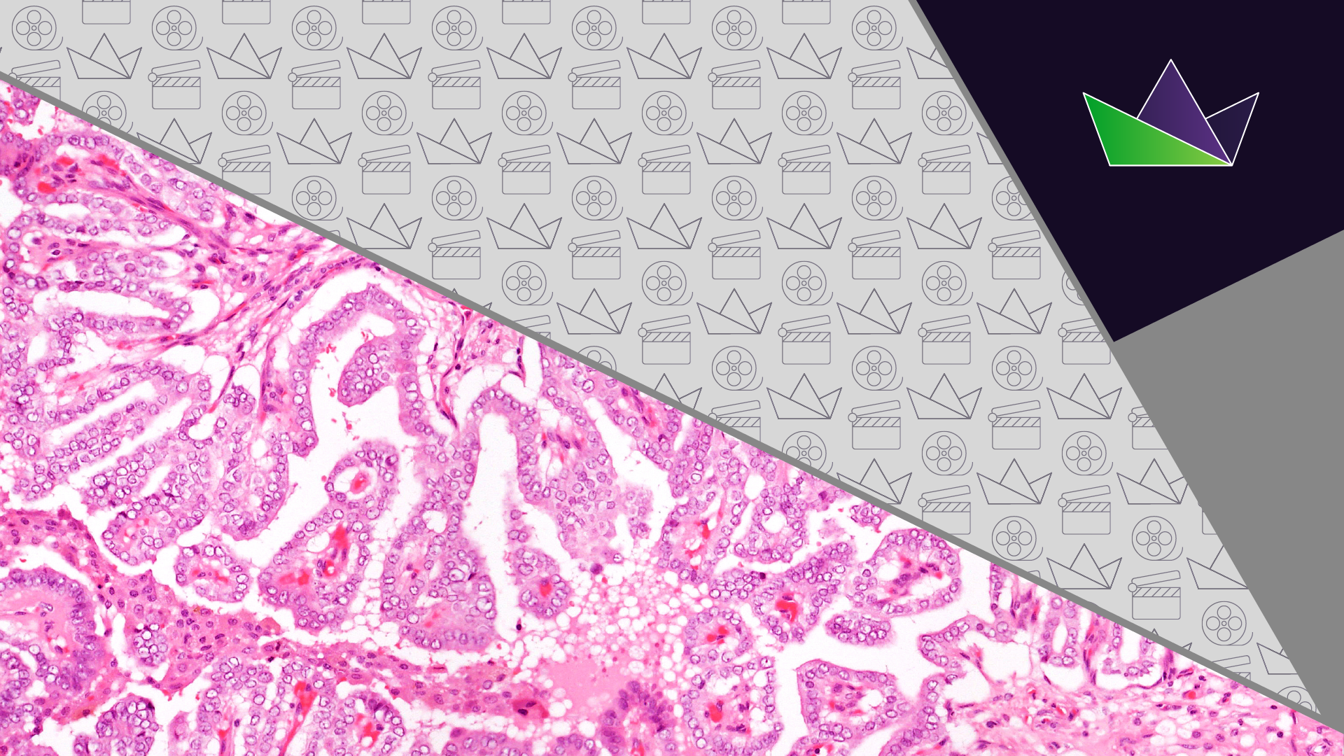 Thyroid cancer sample requirements for RET alteration detection