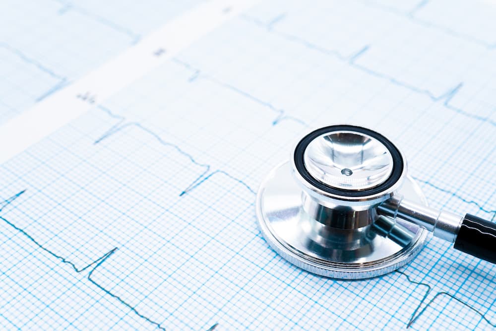 Atrial fibrillation screening and diagnosis