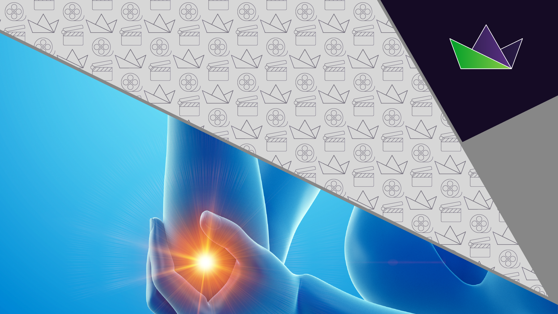 What are key considerations in the management of osteoarthritis-associated pain?