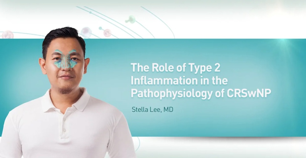 The Role of Type 2 Inﬂammation in the Pathophysiology of CRSwNP