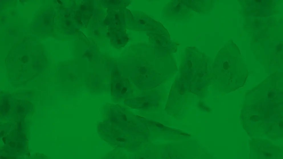 Micrograph of human cheek epithelial cells; recoloured