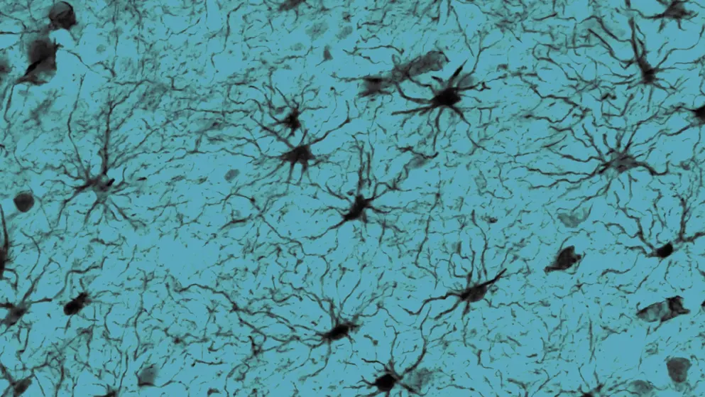 Cerebral cortex Protoplasmic astrocytes, cell image, blue overlay