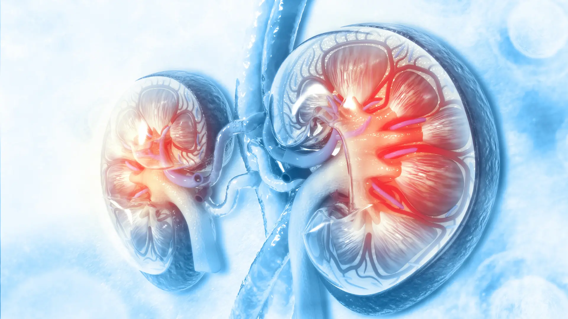 Chronic Kidney Disease - Medthority