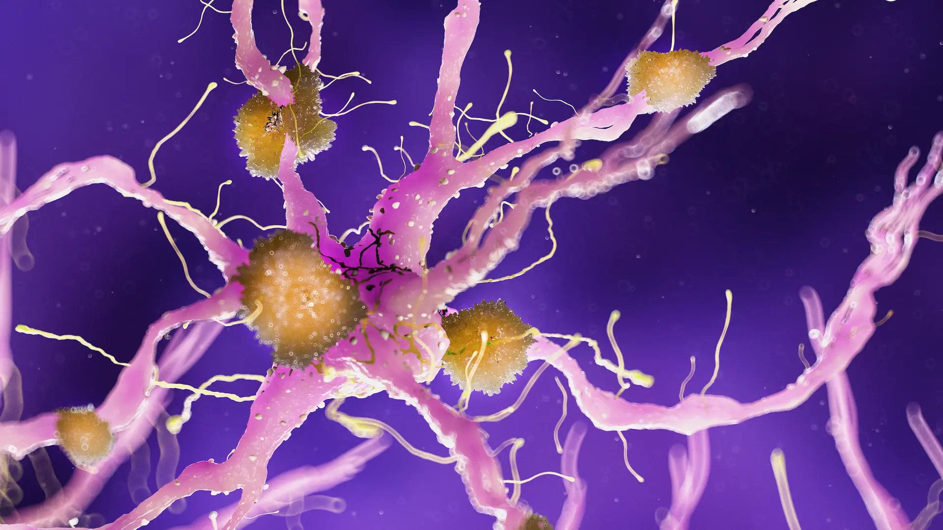 Hattr Hereditary ATTR amyloidosis - Independent resources - Medthority