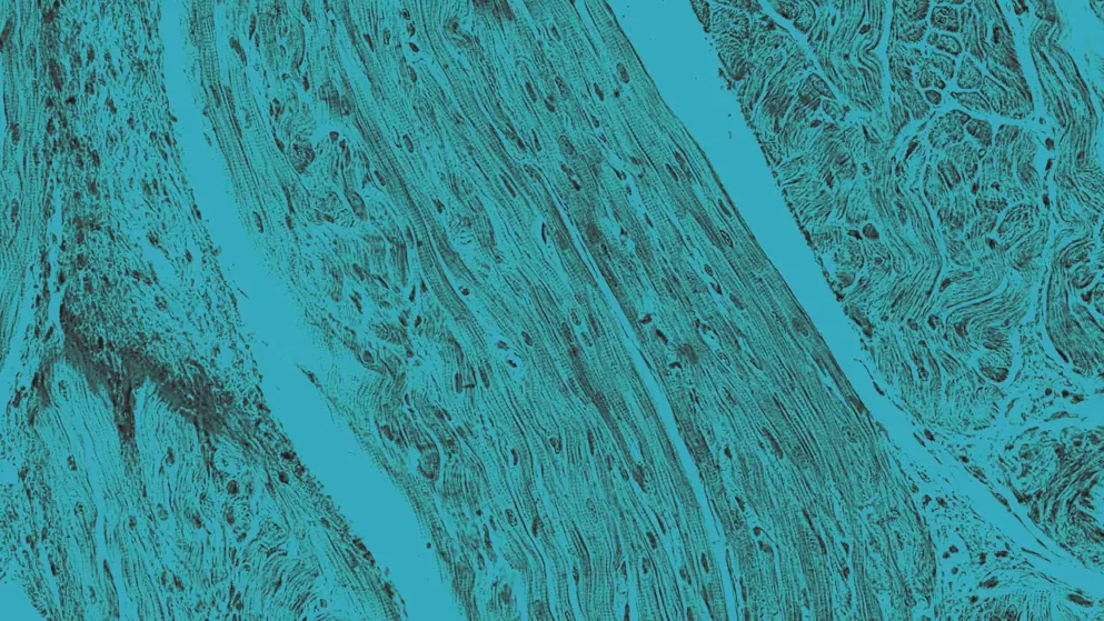 Cellular image, Heart muscle tissue, blue overlay