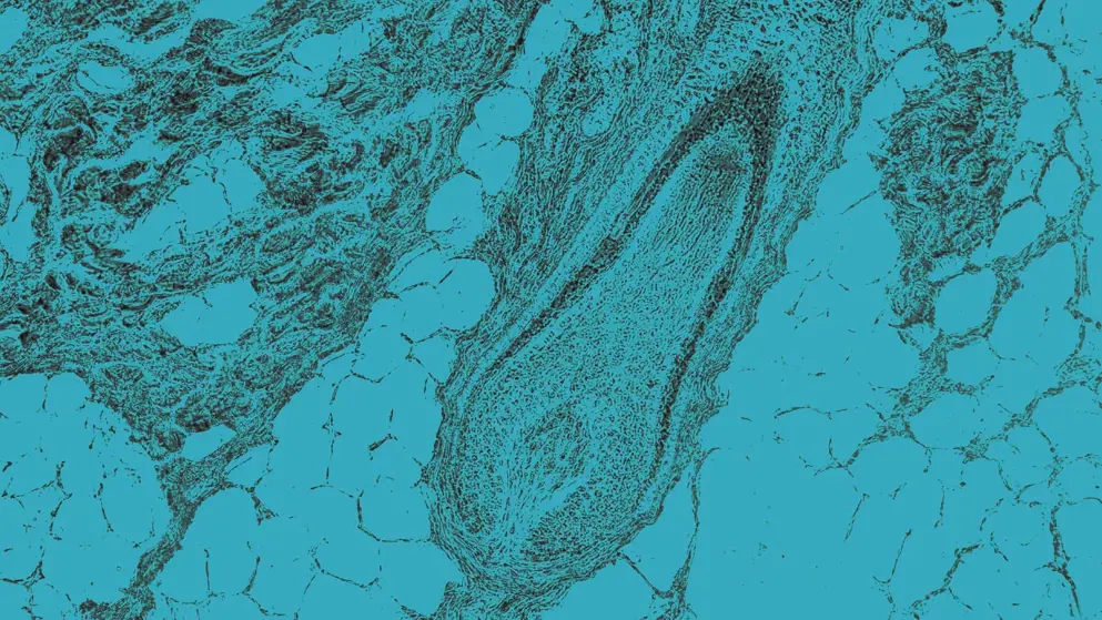 Scalp and hair follicles, cellular image, blue overlay