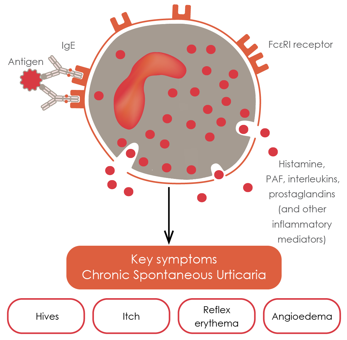 IgE interactions with mast cells in CSU