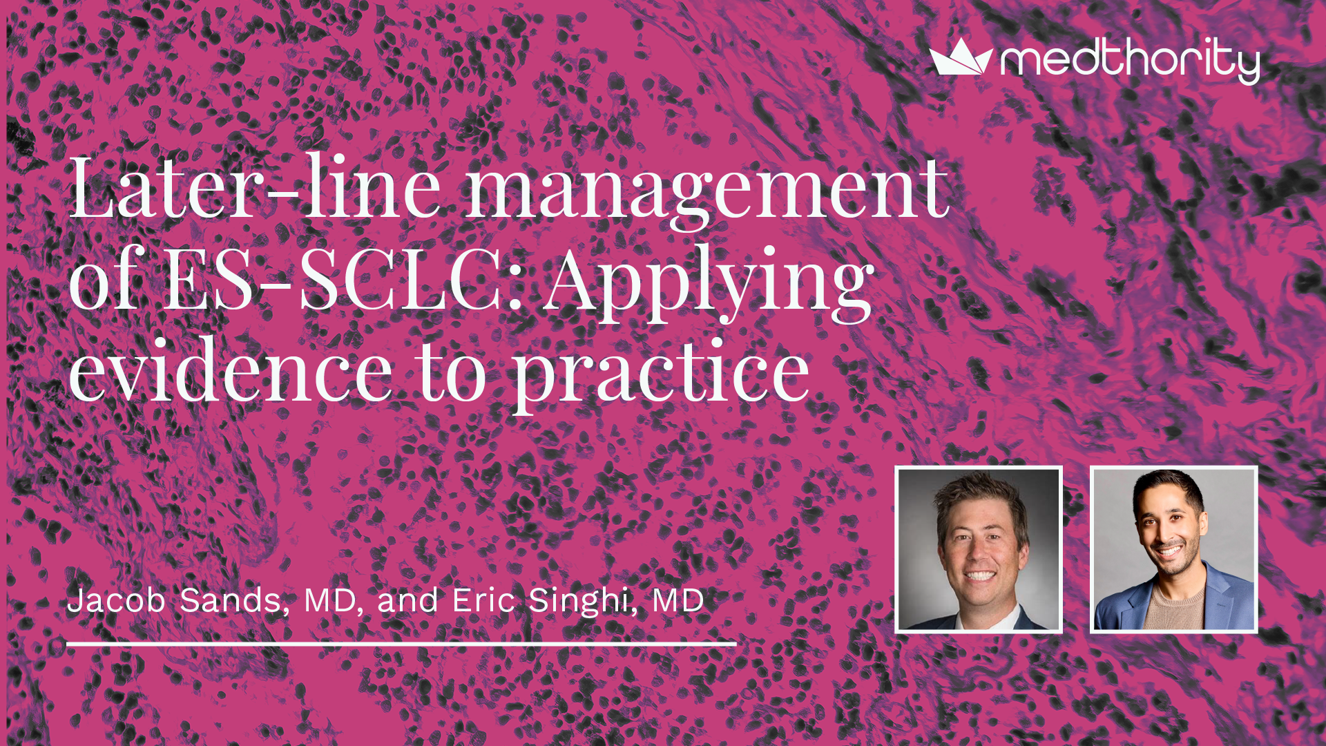 Thumbnail for Youtube Later-Line management of ES-SCLC