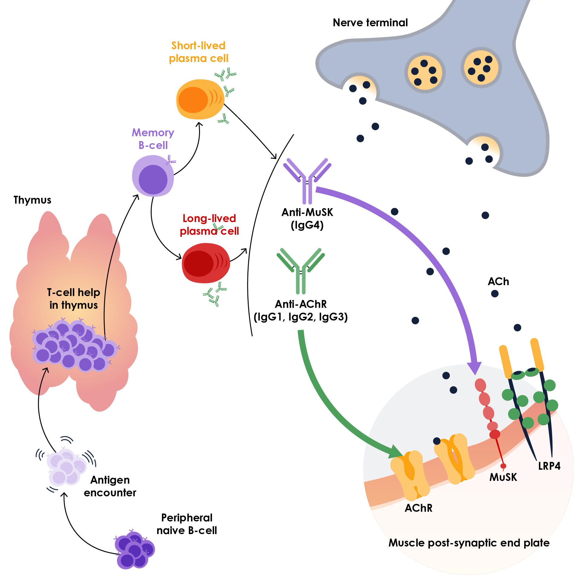 Pathological process of myasthenia gravis at a postsynaptic receptor at the neuromuscular junction