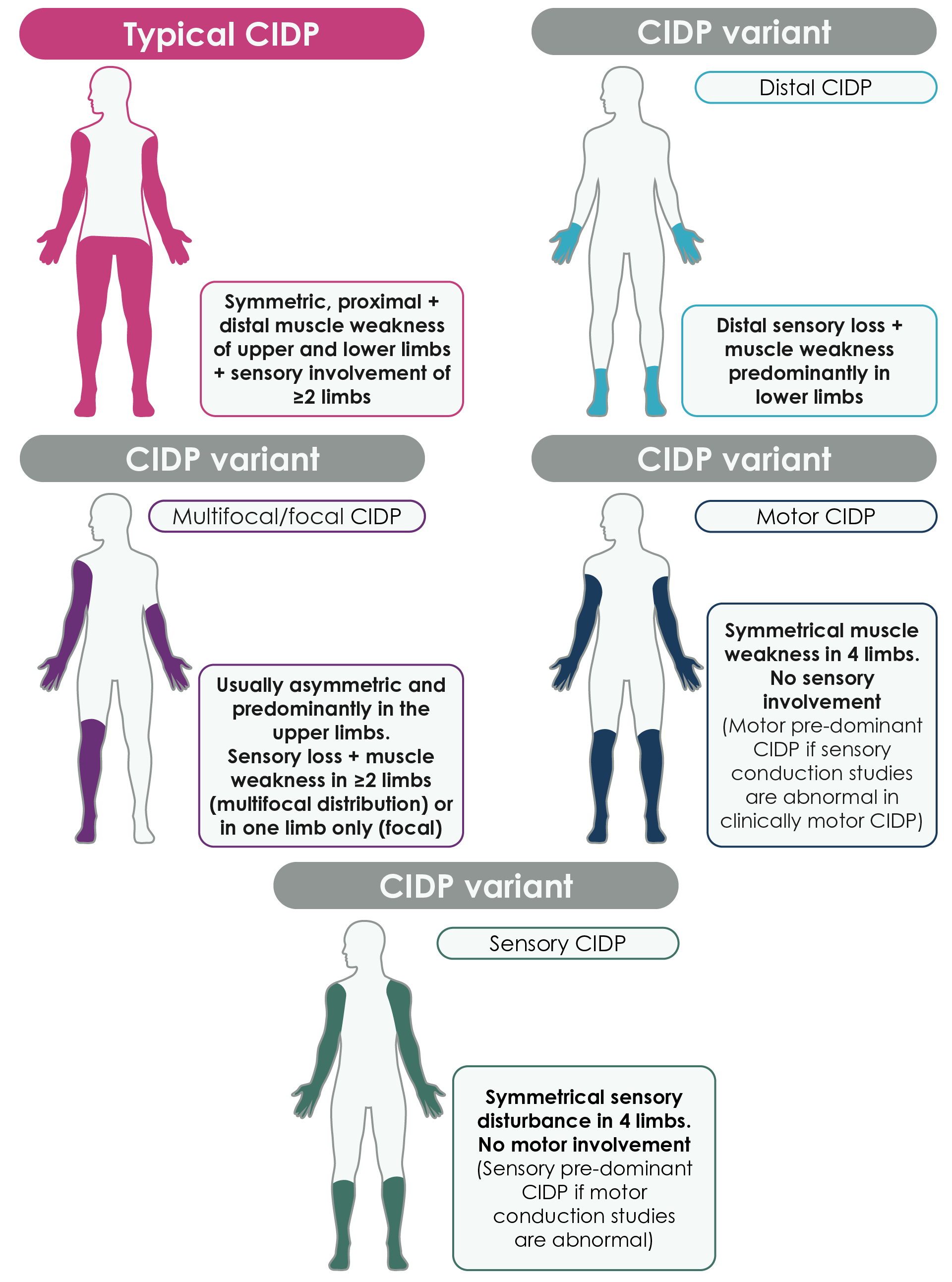 Diagram of five people illustrating different types of CIDP: the first person represents typical CIDP, while the other four represent the distal, multifocal/focal, motor, and sensory CIDP variants.