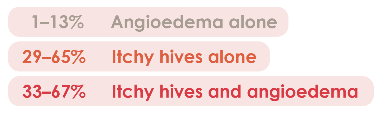 Percentage of CSU patients with angioedema alone, hives or both