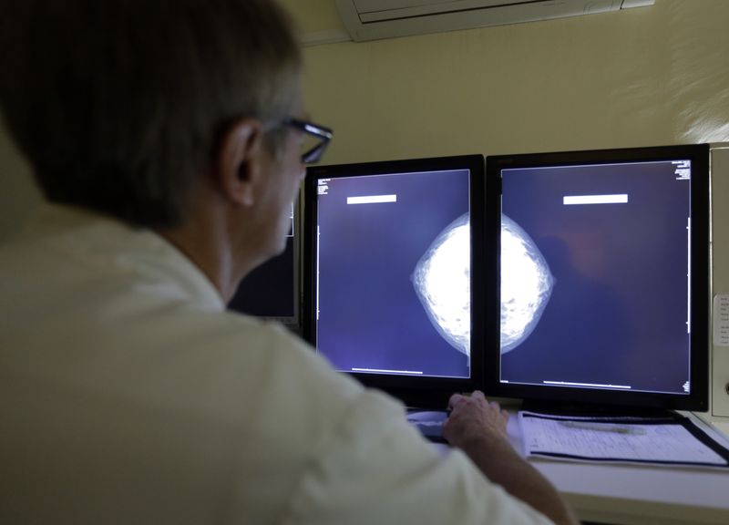 Health Rounds: Genetic testing improves treatment, survival for Black breast cancer patients-