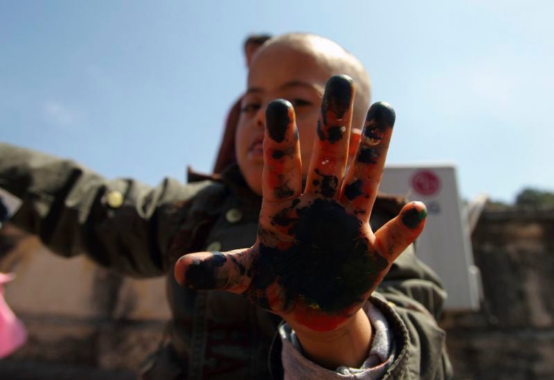 Researchers eye potential Down syndrome fix via advanced gene editing-