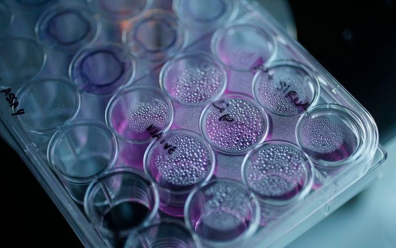 Widely used asthma drug may improve performance of cancer immunotherapies-