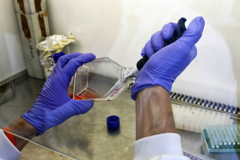CAR-T therapy brings hope to kidney patients with few transplant options-